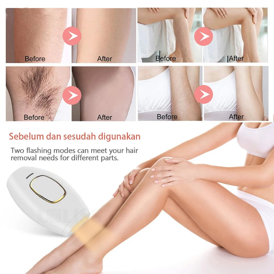 PAKISS New Design Electric Permanent Painless Ipl Laser Hair Removal Device Epilator Ipl Hair Removal Laser